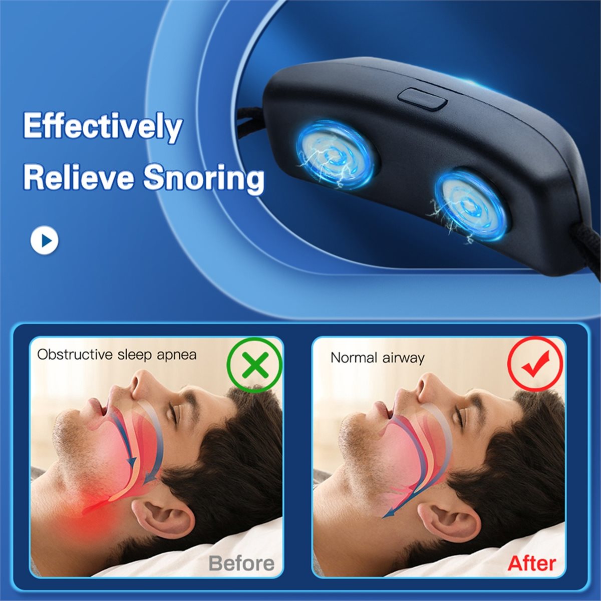 Trend Health And Wellness - 2026 Trend EMS Pulse Stop Snore