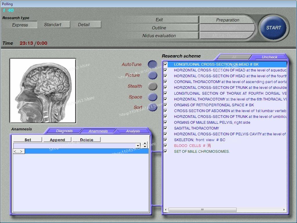 3D NLS Bioresonantie Scanner & - Holistic Health & Wellness recensie en prijs